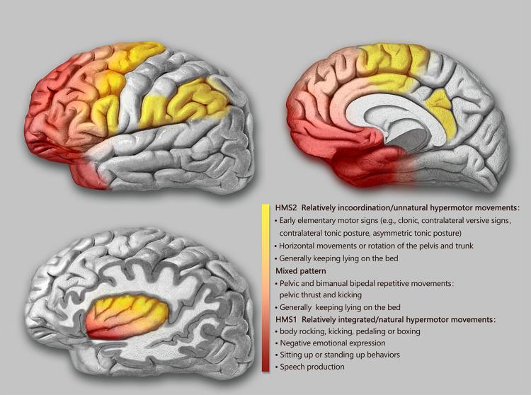 https://cdn.ncbi.nlm.nih.gov/pmc/blobs/e28e/8598206/435da1008579/NSS-13-2065-g0002.jpg