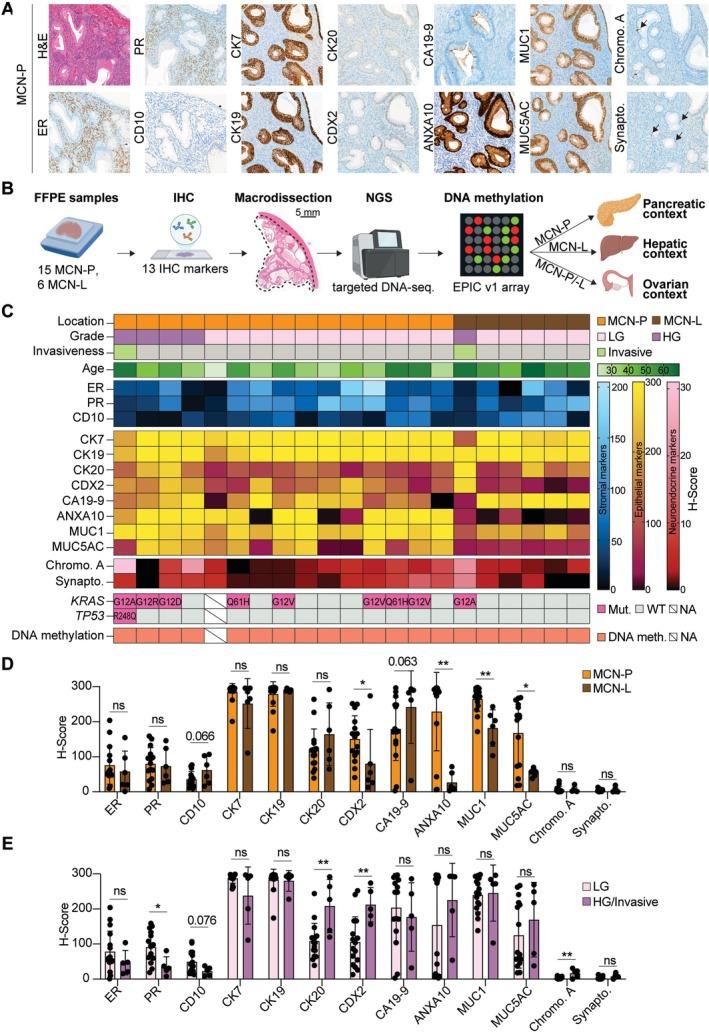 https://cdn.ncbi.nlm.nih.gov/pmc/blobs/e28f/12337810/d1791f7a1122/PATH-267-10-g001.jpg