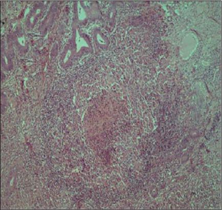https://cdn.ncbi.nlm.nih.gov/pmc/blobs/e290/5591487/1537316e3cb7/VetWorld-10-964-g014.jpg