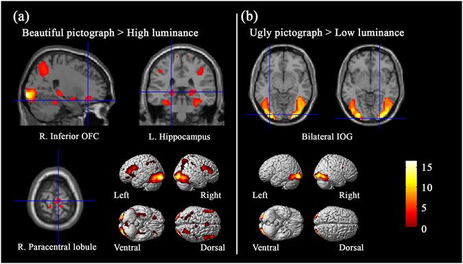 https://cdn.ncbi.nlm.nih.gov/pmc/blobs/e293/5541072/adf35700182e/41598_2017_7608_Fig1_HTML.jpg