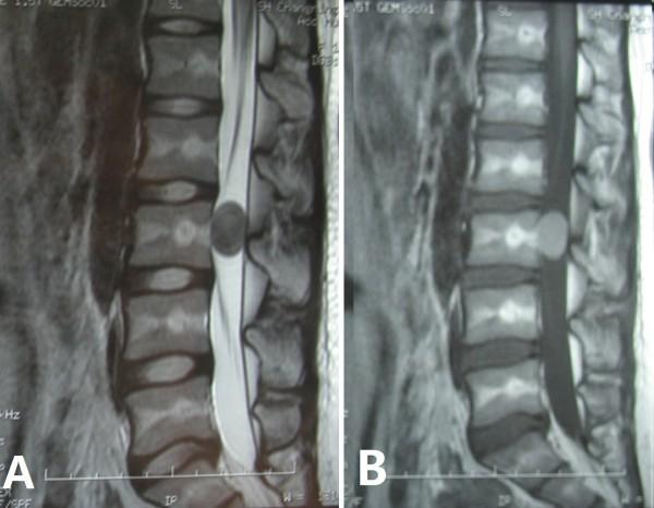 https://cdn.ncbi.nlm.nih.gov/pmc/blobs/e295/3975861/f770f4821ac5/1477-7819-12-50-1.jpg