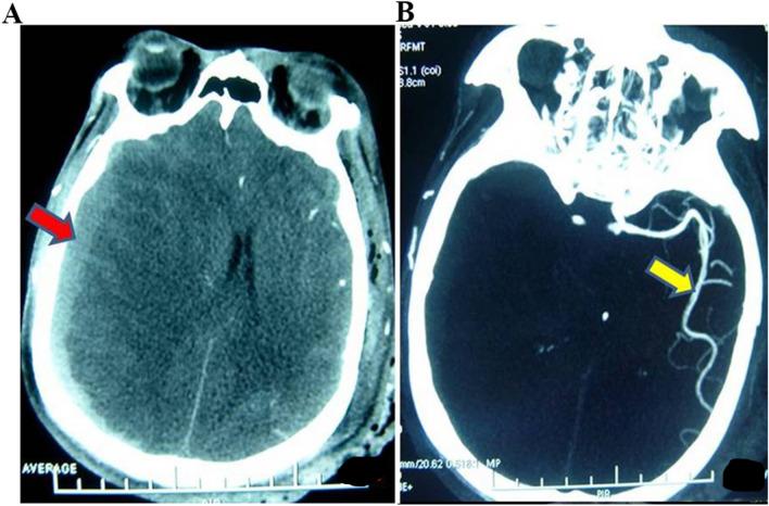 https://cdn.ncbi.nlm.nih.gov/pmc/blobs/e2a0/10799957/22b5963c280b/41598_2024_52385_Fig3_HTML.jpg