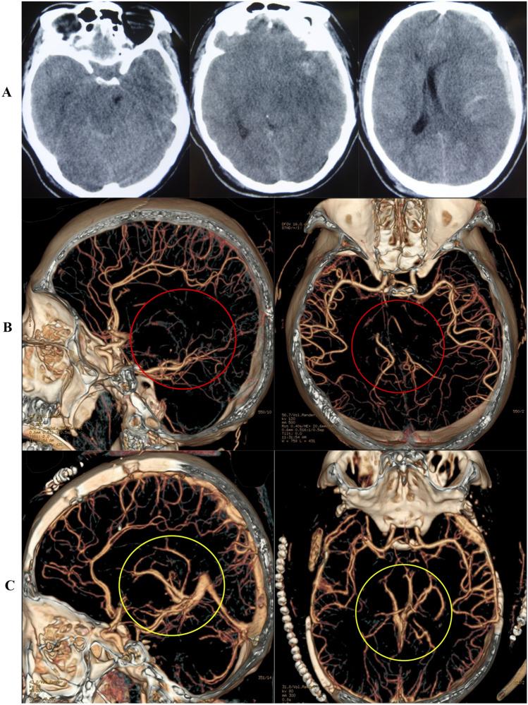 https://cdn.ncbi.nlm.nih.gov/pmc/blobs/e2a0/10799957/ff33b57cf479/41598_2024_52385_Fig4_HTML.jpg