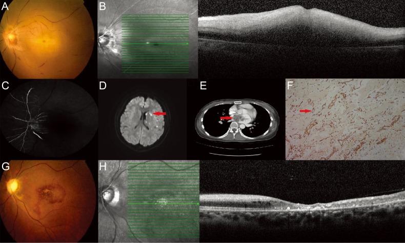 https://cdn.ncbi.nlm.nih.gov/pmc/blobs/e2a0/5327180/958c32ad804f/kjo-31-88-g001.jpg