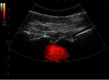 https://cdn.ncbi.nlm.nih.gov/pmc/blobs/e2a2/8175124/99074d6c2134/NP2021-5558138.002.jpg