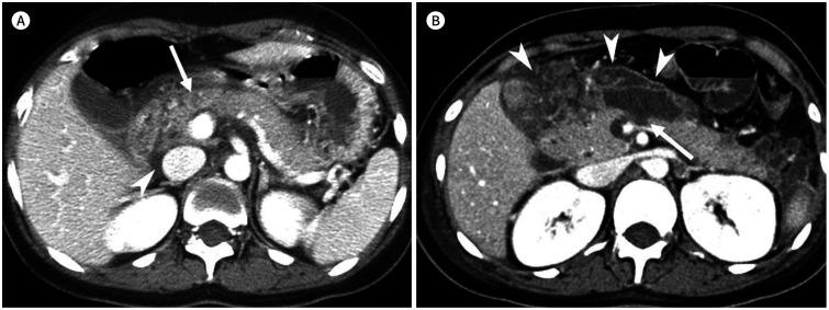 https://cdn.ncbi.nlm.nih.gov/pmc/blobs/e2a5/9431828/b0fef9977b62/jksr-81-1436-g002.jpg