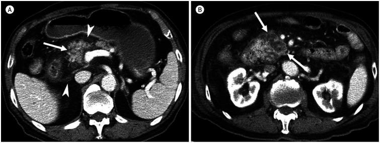 https://cdn.ncbi.nlm.nih.gov/pmc/blobs/e2a5/9431828/c8dbe4777a28/jksr-81-1436-g003.jpg