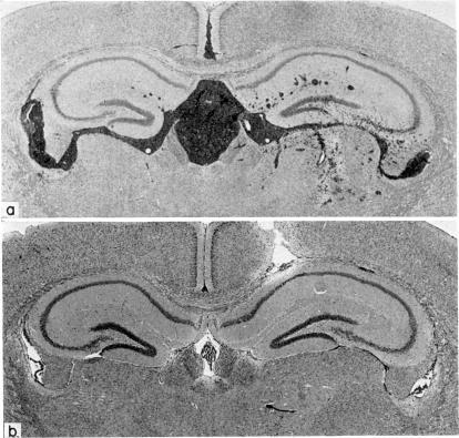 https://cdn.ncbi.nlm.nih.gov/pmc/blobs/e2ab/1538104/d1e9a2718d3d/clinexpimmunol00264-0154-a.jpg