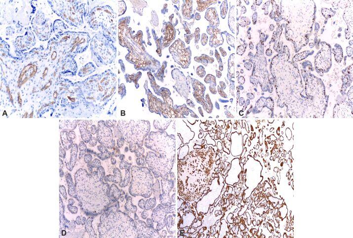 https://cdn.ncbi.nlm.nih.gov/pmc/blobs/e2af/9019607/6b4e2aee55c5/RJME-62-3-855-fig4.jpg