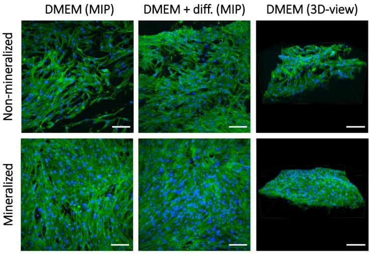 https://cdn.ncbi.nlm.nih.gov/pmc/blobs/e2b9/11988939/161b1288ddf6/ijms-26-02974-g017.jpg
