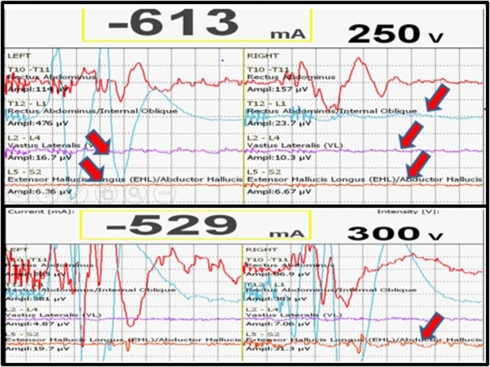 https://cdn.ncbi.nlm.nih.gov/pmc/blobs/e2be/5303707/f184d055756e/fsurg-04-00008-g002.jpg