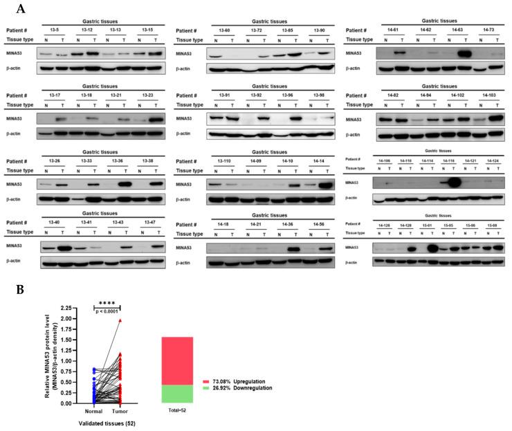 https://cdn.ncbi.nlm.nih.gov/pmc/blobs/e2c1/7281541/dfa11f888d07/cancers-12-01141-g003.jpg