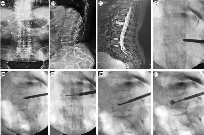 https://cdn.ncbi.nlm.nih.gov/pmc/blobs/e2ce/6567733/57f0c9abb6bc/10.1177_0300060519836917-fig2.jpg