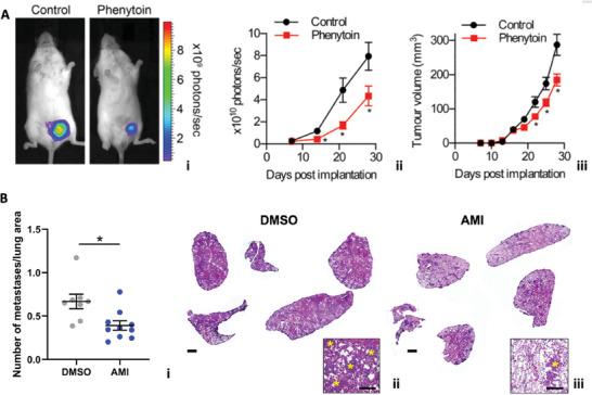https://cdn.ncbi.nlm.nih.gov/pmc/blobs/e2d0/10767462/7bddbb7ccdb2/ADVS-11-2304110-g013.jpg