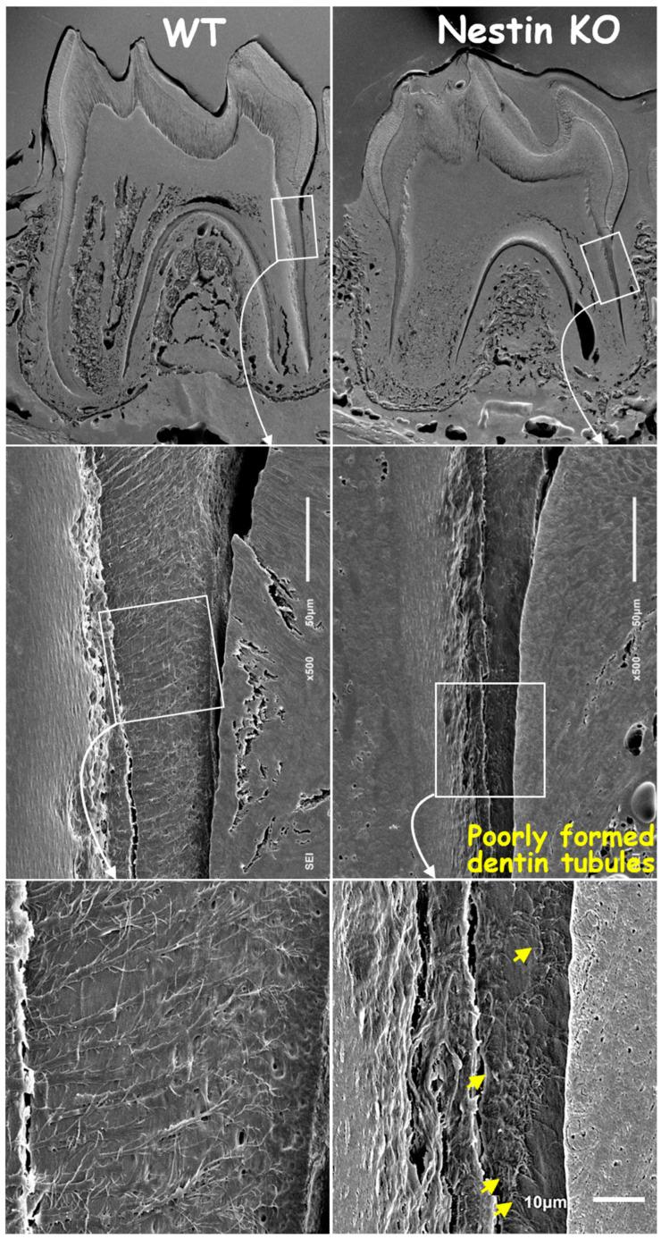 https://cdn.ncbi.nlm.nih.gov/pmc/blobs/e2d0/11941000/2ec352a85708/dentistry-13-00113-g004.jpg