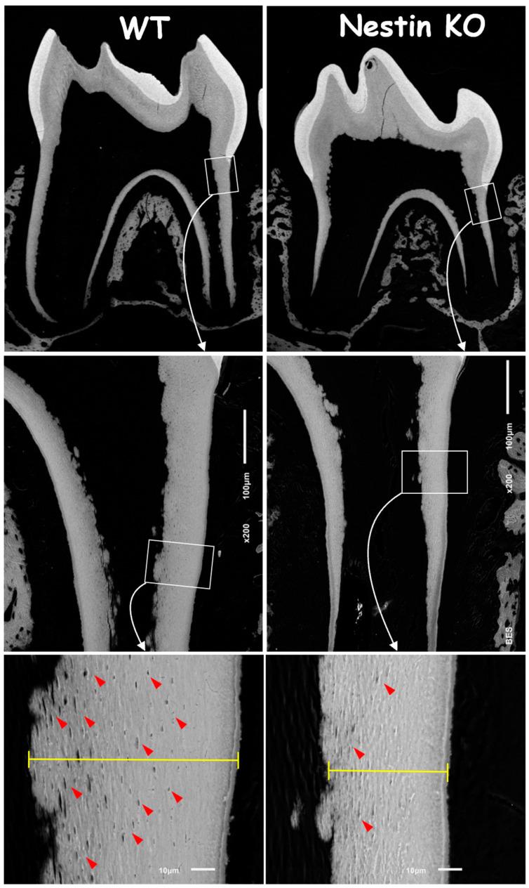 https://cdn.ncbi.nlm.nih.gov/pmc/blobs/e2d0/11941000/5d94bde15fe0/dentistry-13-00113-g003.jpg