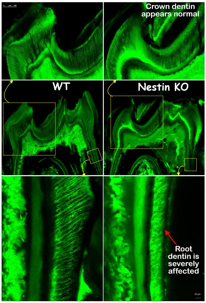 https://cdn.ncbi.nlm.nih.gov/pmc/blobs/e2d0/11941000/8605a2e4b315/dentistry-13-00113-g005.jpg