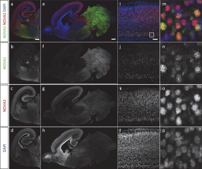 https://cdn.ncbi.nlm.nih.gov/pmc/blobs/e2d4/4930328/1c47961870ee/elife-14371-fig2-figsupp3.jpg