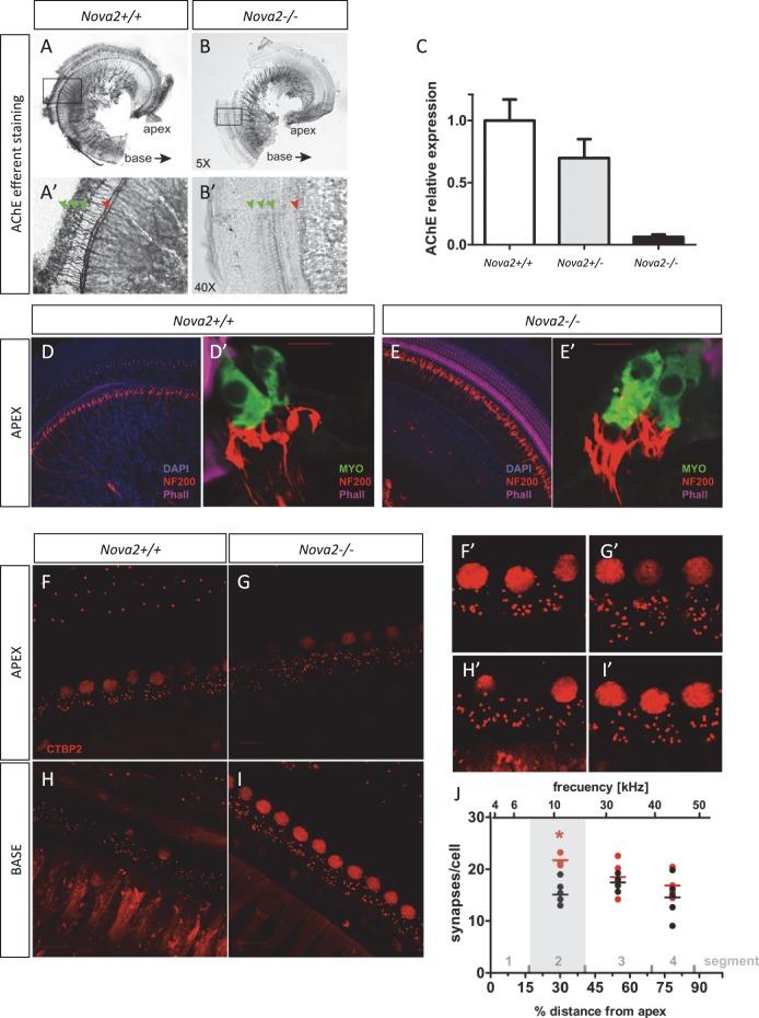https://cdn.ncbi.nlm.nih.gov/pmc/blobs/e2d4/4930328/8db5f56c5280/elife-14371-fig10-figsupp1.jpg