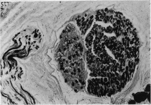 https://cdn.ncbi.nlm.nih.gov/pmc/blobs/e2d6/1244375/065698d387cb/janat00441-0117-e.jpg