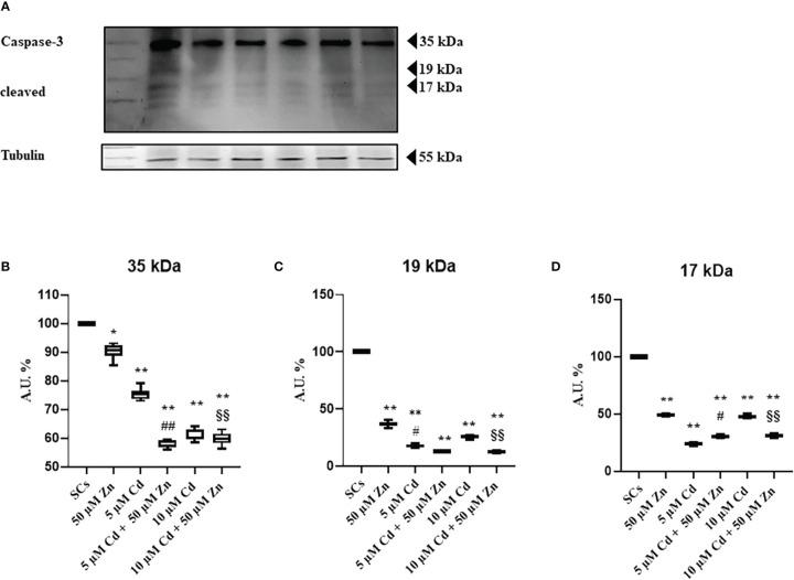 https://cdn.ncbi.nlm.nih.gov/pmc/blobs/e2d6/9950629/919b760892ac/fendo-14-962519-g003.jpg