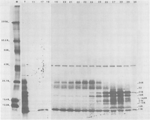 https://cdn.ncbi.nlm.nih.gov/pmc/blobs/e2d9/256350/244d198a9399/jvirol00153-0160-a.jpg
