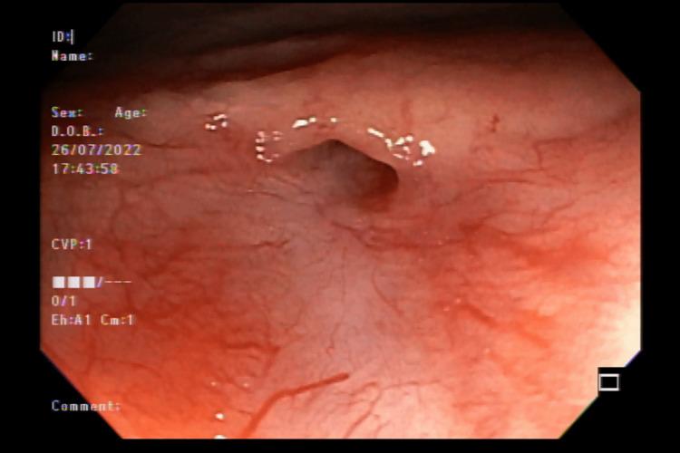 https://cdn.ncbi.nlm.nih.gov/pmc/blobs/e2dd/9891095/72f4821d8239/cureus-0015-00000033250-i02.jpg