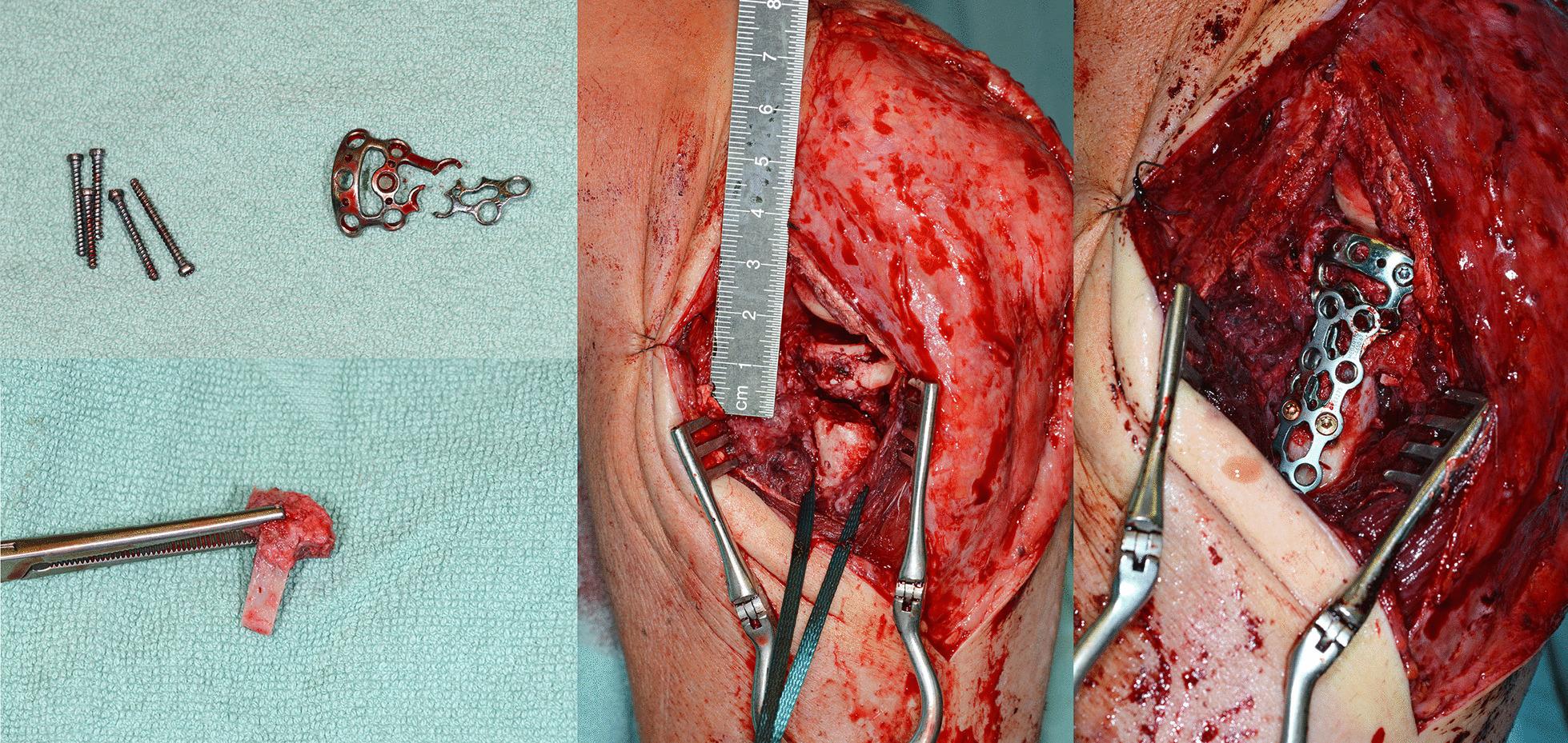 https://cdn.ncbi.nlm.nih.gov/pmc/blobs/e2e2/9675101/0e27457e046a/13018_2022_3394_Fig4_HTML.jpg