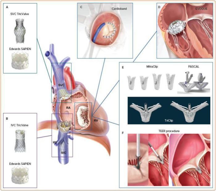https://cdn.ncbi.nlm.nih.gov/pmc/blobs/e2e5/12369743/0d8af45a8348/ms9-87-4262-g003.jpg