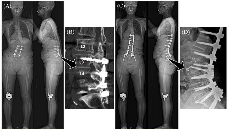 https://cdn.ncbi.nlm.nih.gov/pmc/blobs/e2ef/12386415/0a62b353305f/jcm-14-05643-g001.jpg