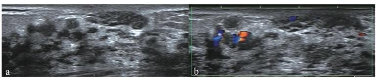 https://cdn.ncbi.nlm.nih.gov/pmc/blobs/e2ef/9777234/3e24bc8538a1/diagnostics-12-02923-g001.jpg