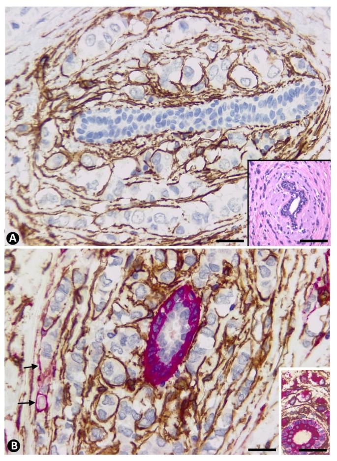 https://cdn.ncbi.nlm.nih.gov/pmc/blobs/e2f1/8037555/69d06c96f839/ijms-22-03686-g004.jpg