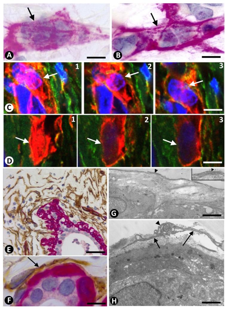 https://cdn.ncbi.nlm.nih.gov/pmc/blobs/e2f1/8037555/c8e2765a8d7f/ijms-22-03686-g003.jpg