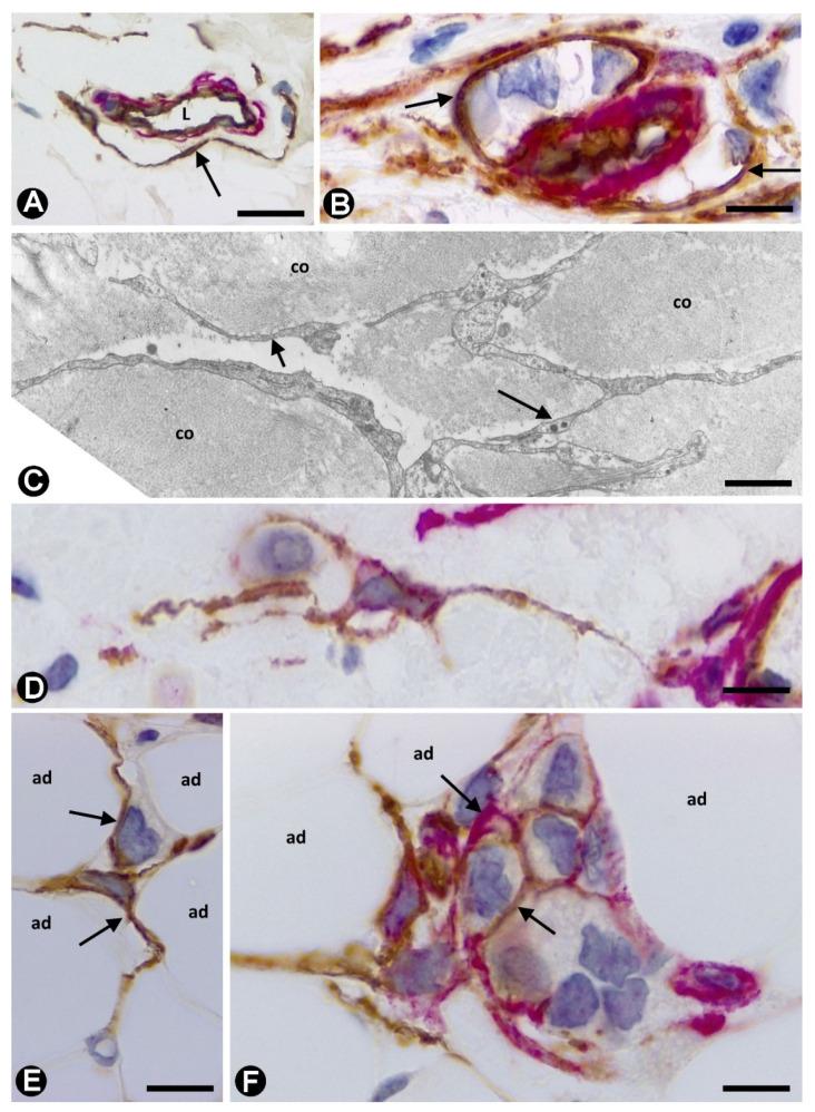 https://cdn.ncbi.nlm.nih.gov/pmc/blobs/e2f1/8037555/ef31a17436c2/ijms-22-03686-g007.jpg