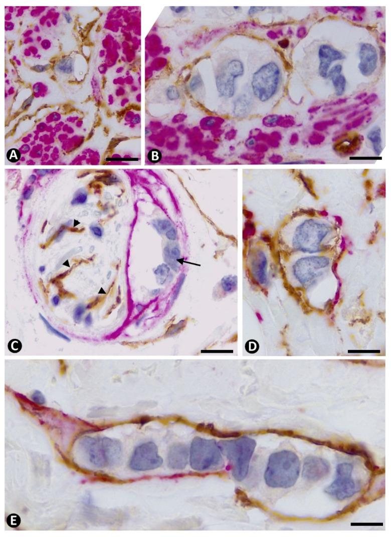 https://cdn.ncbi.nlm.nih.gov/pmc/blobs/e2f1/8037555/fbc1f7b8886e/ijms-22-03686-g008.jpg