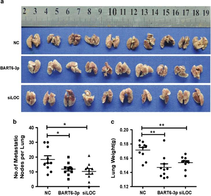 https://cdn.ncbi.nlm.nih.gov/pmc/blobs/e2fd/5059857/7545d962dfa6/cddis2016253f5.jpg