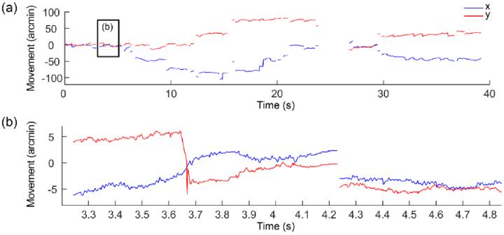 https://cdn.ncbi.nlm.nih.gov/pmc/blobs/e302/10890855/e8316221b1ab/boe-15-2-1311-g014.jpg