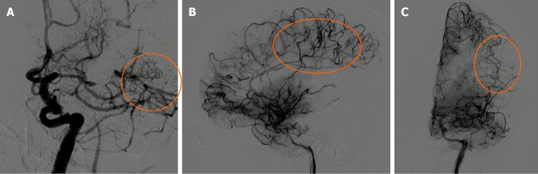 https://cdn.ncbi.nlm.nih.gov/pmc/blobs/e331/11238813/ada543db9d38/WJCC-12-5145-g003.jpg
