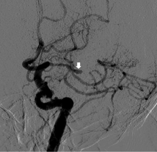 https://cdn.ncbi.nlm.nih.gov/pmc/blobs/e331/11238813/cea6a5192852/WJCC-12-5145-g001.jpg