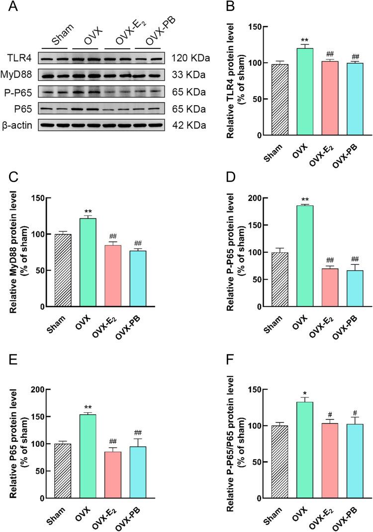 https://cdn.ncbi.nlm.nih.gov/pmc/blobs/e334/12186810/7edbdbe3a071/JIR-18-8153-g0005.jpg