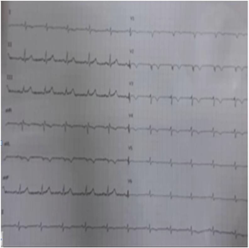 https://cdn.ncbi.nlm.nih.gov/pmc/blobs/e342/9422315/12c67f88efe5/gr2.jpg