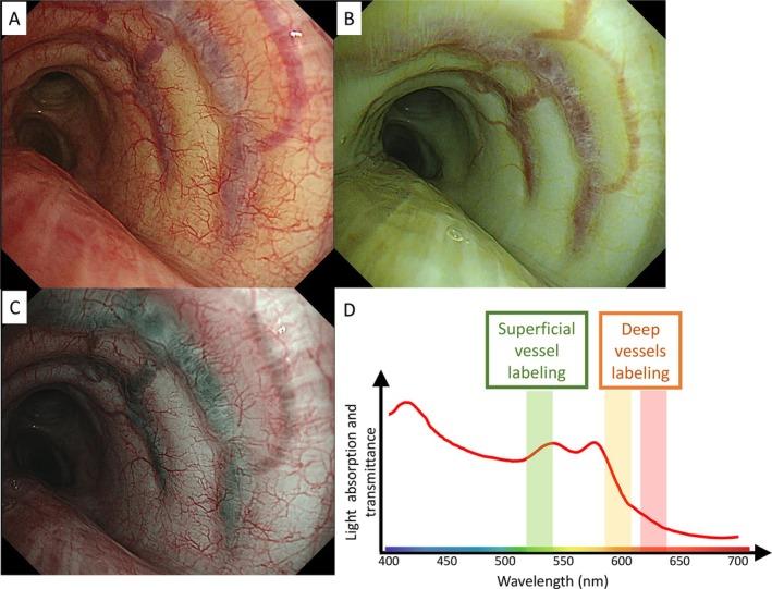 https://cdn.ncbi.nlm.nih.gov/pmc/blobs/e343/11986264/659d8774f398/TCA-16-e70065-g002.jpg