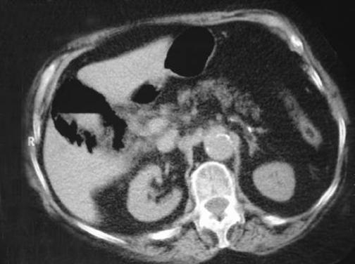 https://cdn.ncbi.nlm.nih.gov/pmc/blobs/e343/3015641/d5c8d280c142/jsls-9-4-478-g02.jpg