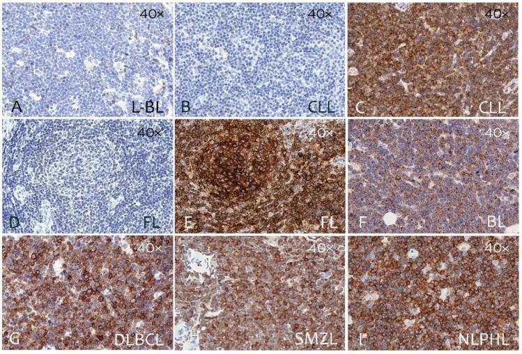 https://cdn.ncbi.nlm.nih.gov/pmc/blobs/e343/9101303/1ab0d7849b94/cancers-14-02154-g004.jpg