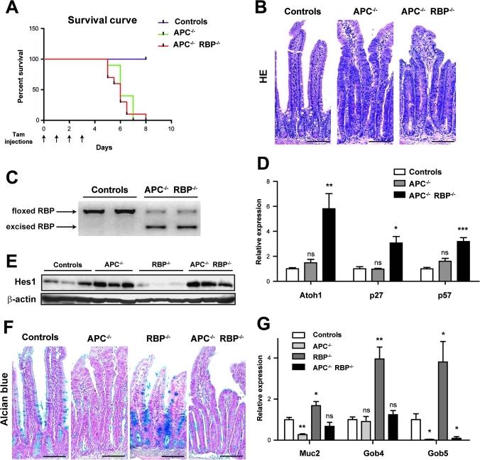 https://cdn.ncbi.nlm.nih.gov/pmc/blobs/e34c/3022366/25dbdd695f1a/gutjnl204719fig5.jpg