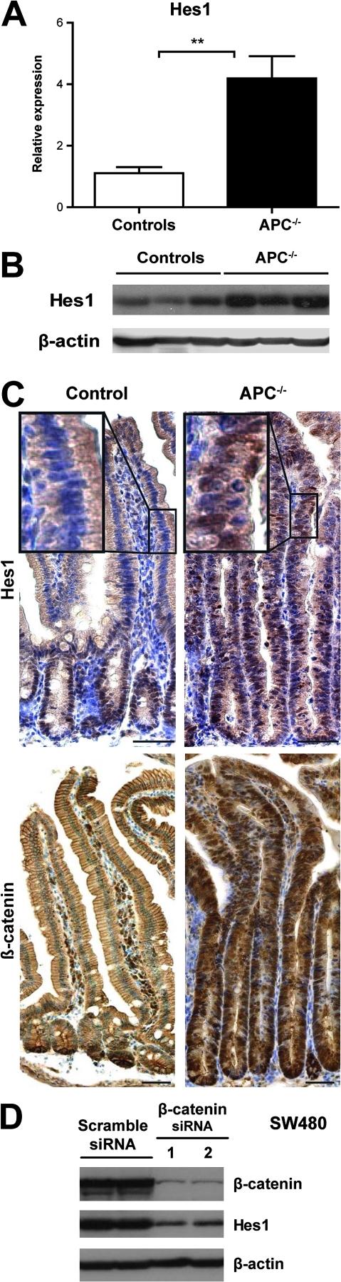 https://cdn.ncbi.nlm.nih.gov/pmc/blobs/e34c/3022366/2ec06519867b/gutjnl204719fig3.jpg