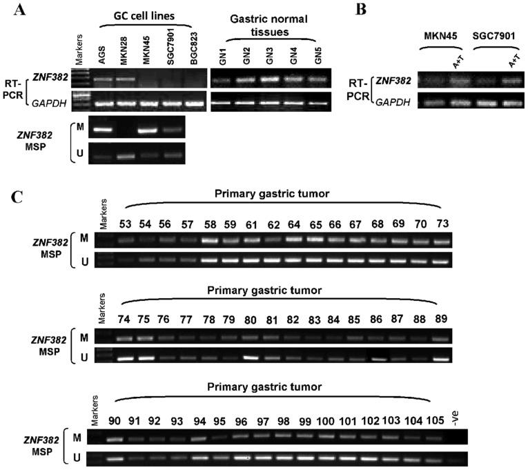 https://cdn.ncbi.nlm.nih.gov/pmc/blobs/e34d/6065451/4d9273aad80f/IJO-53-03-0961-g01.jpg