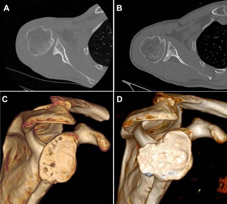 https://cdn.ncbi.nlm.nih.gov/pmc/blobs/e351/7844463/d80218db4eca/10.1177_2325967120976378-fig4.jpg