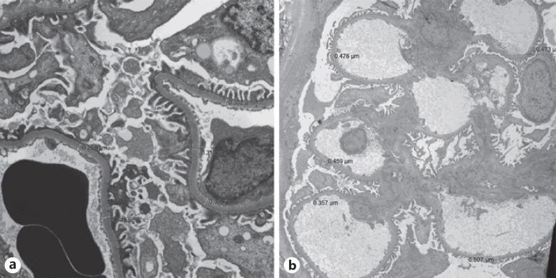 https://cdn.ncbi.nlm.nih.gov/pmc/blobs/e361/9677744/144249988b5a/gdz-0001-0135-g09.jpg