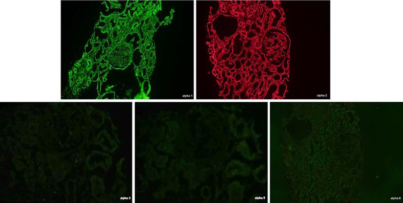 https://cdn.ncbi.nlm.nih.gov/pmc/blobs/e361/9677744/18c2b824b843/gdz-0001-0135-g05.jpg